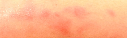 あつまれ‼︎ 雑談&amp;ゲーム好きの森　season２　おしゃべりしよっさ♪♪