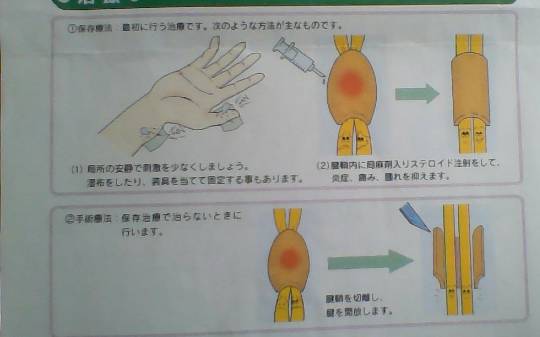マスク同窓会詰所兼ニューフェイス歓迎所34(ありがとう)